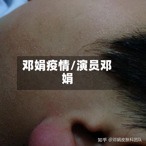 邓娟疫情/演员邓娟-第3张图片